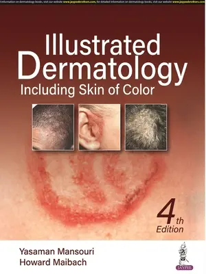 Dermatologia illustrata - Pelle di colore inclusa - Illustrated Dermatology - Including Skin of Colour