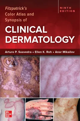 Atlante a colori e sinossi di dermatologia clinica di Fitzpatrick, nona edizione - Fitzpatrick's Color Atlas and Synopsis of Clinical Dermatology, Ninth Edition
