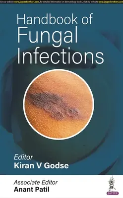 Manuale delle infezioni fungine - Handbook of Fungal Infections