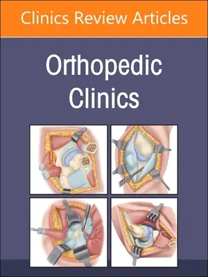 Gestione delle comorbilità, un numero di Orthopedic Clinics: Volume 54-3 - Managing Comorbidities, an Issue of Orthopedic Clinics: Volume 54-3
