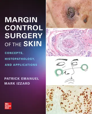 Chirurgia cutanea di controllo del margine: Concetti, istopatologia e applicazioni - Margin Control Surgery of the Skin: Concepts, Histopathology, and Applications