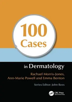 100 casi di dermatologia - 100 Cases in Dermatology