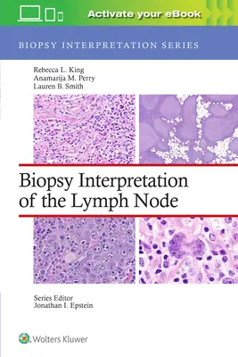 Interpretazione della biopsia del linfonodo - Biopsy Interpretation of the Lymph Node