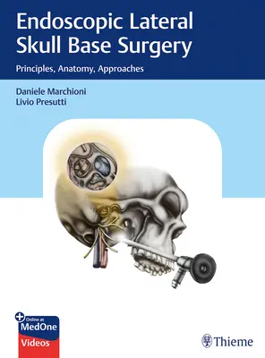 Chirurgia endoscopica laterale della base cranica: Principi, anatomia, approcci - Endoscopic Lateral Skull Base Surgery: Principles, Anatomy, Approaches