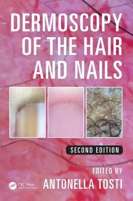 Dermoscopia dei capelli e delle unghie - Dermoscopy of the Hair and Nails