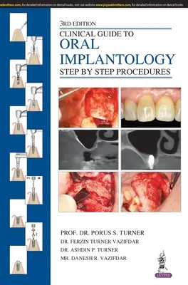 Guida clinica all'implantologia orale: Procedure passo dopo passo - Clinical Guide to Oral Implantology: Step by Step Procedures