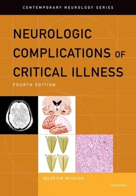 Complicazioni neurologiche della malattia critica - Neurologic Complications of Critical Illness