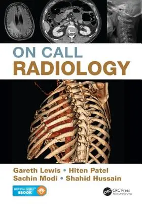 Radiologia su chiamata - On Call Radiology