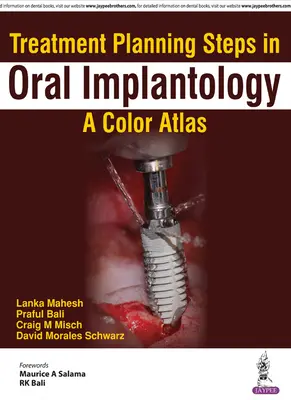 Fasi di pianificazione del trattamento in implantologia orale: Un atlante a colori - Treatment Planning Steps in Oral Implantology: A Color Atlas