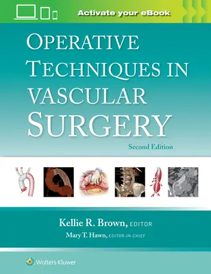 Tecniche operative in chirurgia vascolare - Operative Techniques in Vascular Surgery