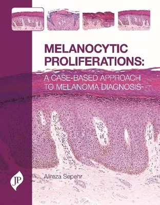 Proliferazioni melanocitiche - Un approccio basato sul caso alla diagnosi di melanoma - Melanocytic Proliferations - A Case-Based Approach to Melanoma Diagnosis