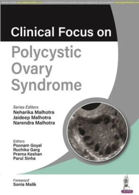 Focus clinico sulla sindrome dell'ovaio policistico - Clinical Focus on Polycystic Ovary Syndrome
