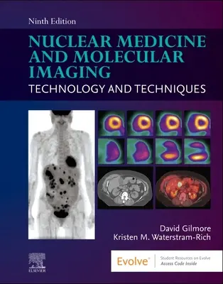 Medicina nucleare e imaging molecolare: Tecnologia e tecniche - Nuclear Medicine and Molecular Imaging: Technology and Techniques