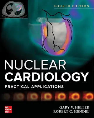 Cardiologia nucleare: Applicazioni pratiche, quarta edizione - Nuclear Cardiology: Practical Applications, Fourth Edition