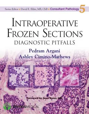 Sezioni congelate intraoperatorie: Insidie diagnostiche - Intraoperative Frozen Sections: Diagnostic Pitfalls