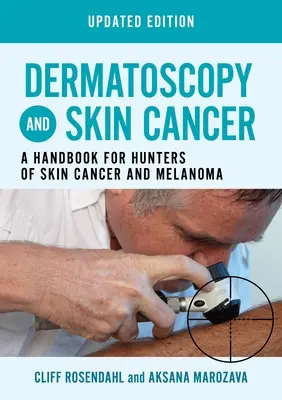 Dermatoscopia e cancro della pelle, edizione aggiornata - Un manuale per i cacciatori di cancro della pelle e melanoma - Dermatoscopy and Skin Cancer, updated edition - A handbook for hunters of skin cancer and melanoma