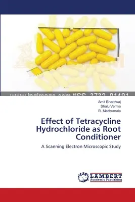 Effetto della tetraciclina cloridrato come condizionatore delle radici - Effect of Tetracycline Hydrochloride as Root Conditioner