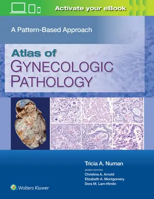 Atlante di patologia ginecologica: Un approccio basato sui modelli - Atlas of Gynecologic Pathology: A Pattern-Based Approach