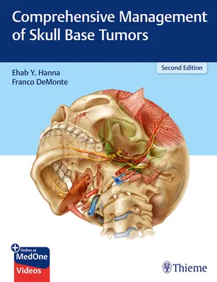 Gestione completa dei tumori della base cranica - Comprehensive Management of Skull Base Tumors