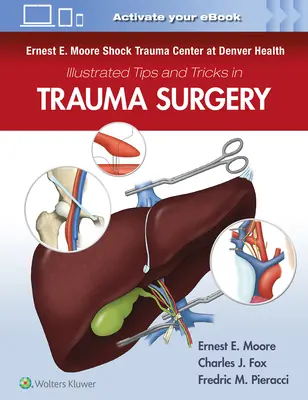 Ernest E. Moore Shock Trauma Center del Denver Health Consigli e trucchi illustrati per la chirurgia del trauma - Ernest E. Moore Shock Trauma Center at Denver Health Illustrated Tips and Tricks in Trauma Surgery
