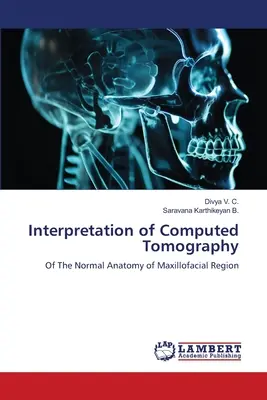 Interpretazione della tomografia computerizzata - Interpretation of Computed Tomography