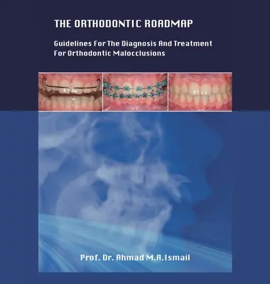 La tabella di marcia ortodontica: Linee guida per la diagnosi e il trattamento delle malocclusioni ortodontiche - The Orthodontic Roadmap: Guidelines for the Diagnosis and Treatment of Orthodontic Malocclusions