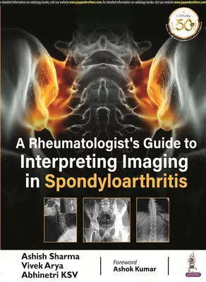 Guida del reumatologo all'interpretazione dell'imaging nelle spondiloartriti - Rheumatologist's Guide to Interpreting Imaging in Spondyloarthritis