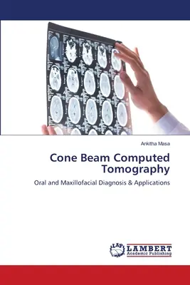 Tomografia computerizzata a fascio conico - Cone Beam Computed Tomography