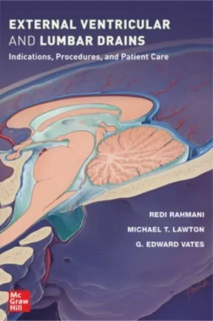 Drenaggi ventricolari e lombari esterni: Indicazioni, procedure e cura del paziente - External Ventricular and Lumbar Drains: Indications, Procedures, and Patient Care