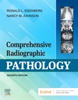 Patologia radiografica completa - Comprehensive Radiographic Pathology