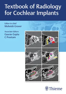 Buku Teks Radiologi untuk Implan Rumah Siput - Textbook of Radiology for Cochlear Implants