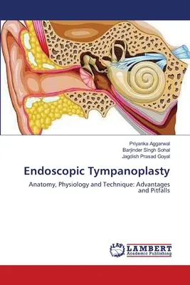 Timpanoplastica endoscopica - Endoscopic Tympanoplasty