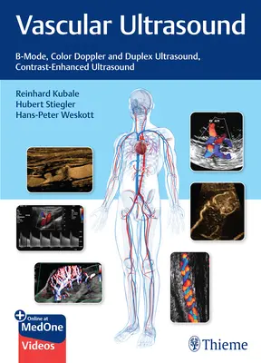 Ecografia vascolare: Ecografia B-Mode, Color Doppler e Duplex, Ecografia con aumento del contrasto - Vascular Ultrasound: B-Mode, Color Doppler and Duplex Ultrasound, Contrast-Enhanced Ultrasound