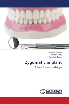 Impianto zigomatico - Zygomatic implant