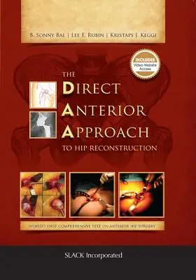 L'approccio anteriore diretto alla ricostruzione dell'anca - The Direct Anterior Approach to Hip Reconstruction