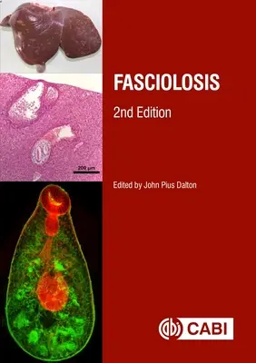 Fasciolosi - Fasciolosis