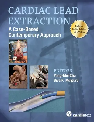 Estrazione di elettrocateteri cardiaci: Un approccio contemporaneo basato su casi concreti - Cardiac Lead Extraction: A Case-Based Contemporary Approach