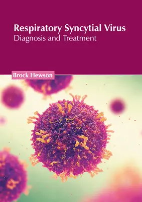 Virus respiratorio sinciziale: Diagnosi e trattamento - Respiratory Syncytial Virus: Diagnosis and Treatment