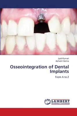 L'osteointegrazione degli impianti dentali - Osseointegration of Dental Implants