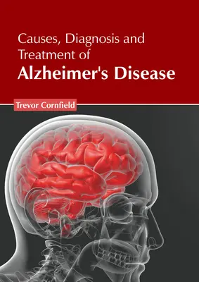 Cause, diagnosi e trattamento della malattia di Alzheimer - Causes, Diagnosis and Treatment of Alzheimer's Disease