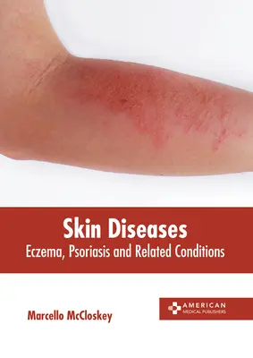 Malattie della pelle: Eczema, psoriasi e condizioni correlate - Skin Diseases: Eczema, Psoriasis and Related Conditions