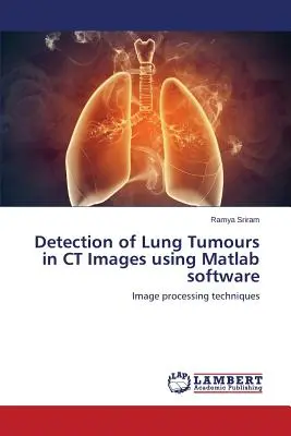 Rilevamento di tumori polmonari in immagini TC utilizzando il software Matlab - Detection of Lung Tumours in CT Images using Matlab software