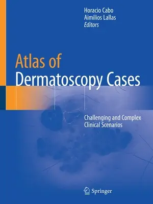 Atlante dei casi di dermatoscopia: Scenari clinici complessi e impegnativi - Atlas of Dermatoscopy Cases: Challenging and Complex Clinical Scenarios