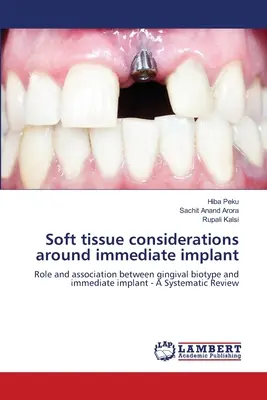 Considerazioni sui tessuti molli intorno all'impianto immediato - Soft tissue considerations around immediate implant