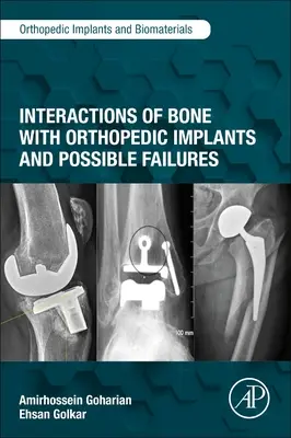Interazioni dell'osso con gli impianti ortopedici e possibili fallimenti - Interactions of Bone with Orthopedic Implants and Possible Failures