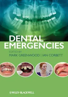 Emergenze dentali - Dental Emergencies