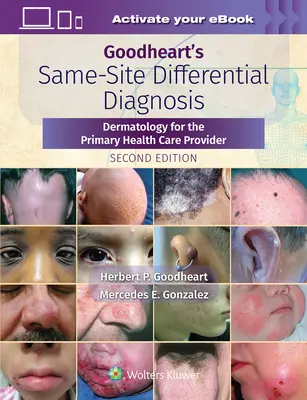 Diagnosi differenziale nello stesso sito di Goodheart: Dermatologia per il medico di base - Goodheart's Same-Site Differential Diagnosis: Dermatology for the Primary Health Care Provider