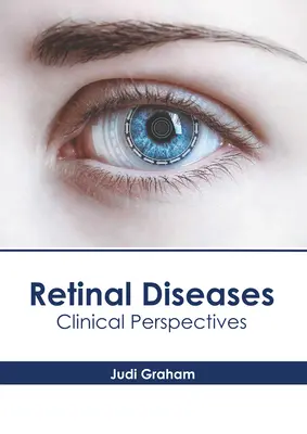 Malattie della retina: Prospettive cliniche - Retinal Diseases: Clinical Perspectives