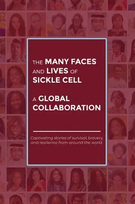 I molti volti e le vite della falcemia - una collaborazione globale - The Many Faces and Lives of Sickle Cell - A Global Collaboration