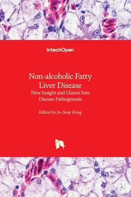 La malattia del fegato grasso non alcolica - Nuovi spunti e sguardi sulla patogenesi della malattia - Non-alcoholic Fatty Liver Disease - New Insight and Glance Into Disease Pathogenesis